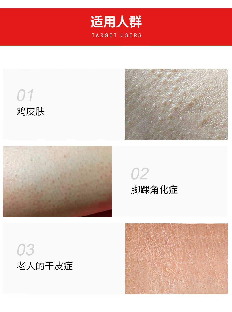 Kobayashi Folliculitis Ointment – Japanese Anti-Folliculitis Cream for Red Bumps & Irritated Skin